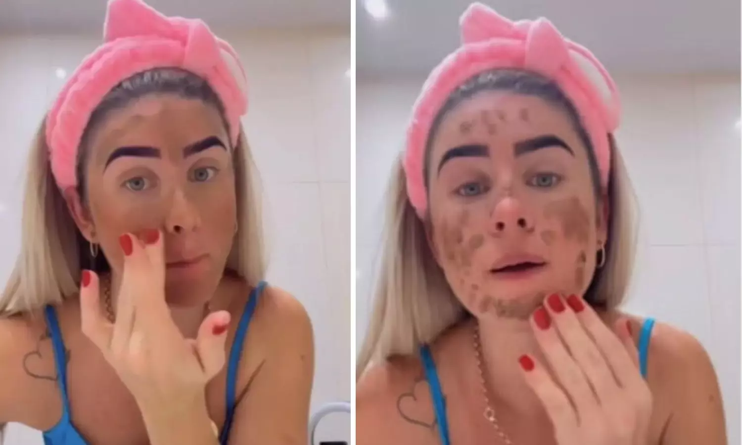 Spanish influencer sparks outrage by applying own feces as face mask