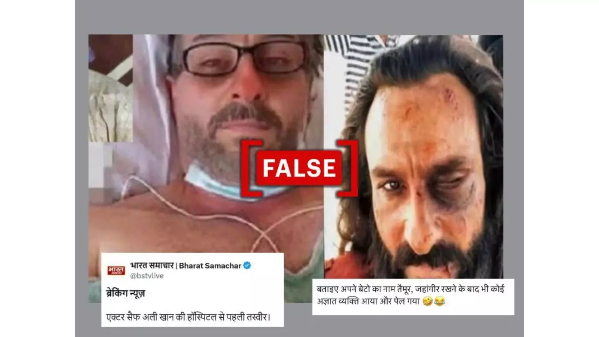 Viral Saif Ali Khan Injury Photos Proven Fake