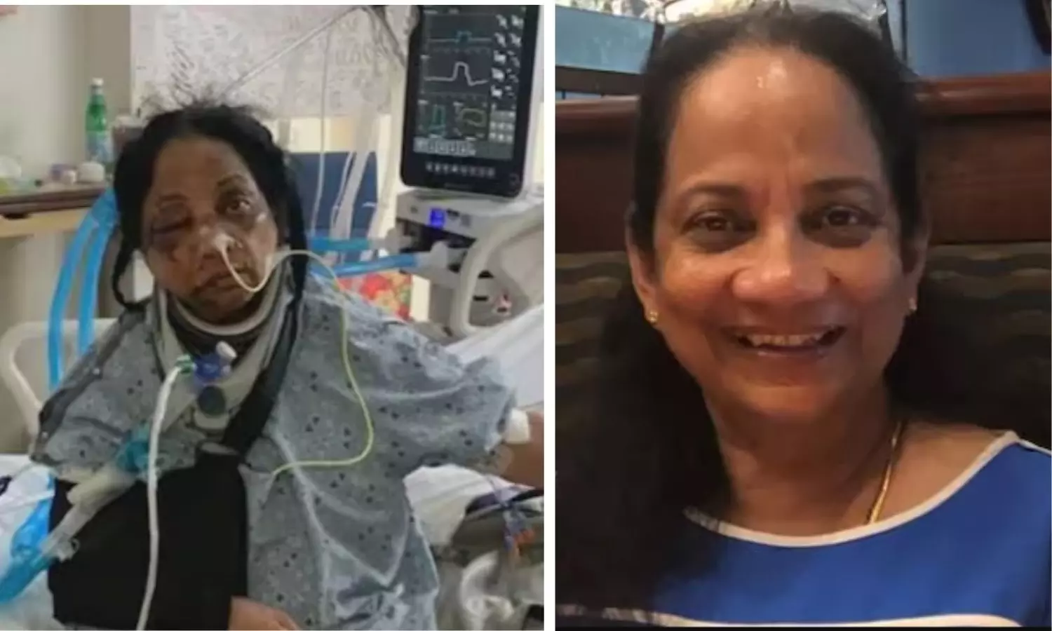 Indian Nurse Brutally Attacked in Florida Hospital in Suspected Hate Crime