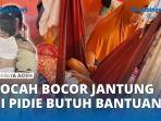 VIDEO - Bocah dari Keluarga Miskin di Pidie Didera Bocor Jantung