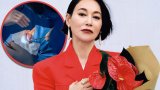 Hong Kong actress Hui Ying-hung reveals 89 facial stitches from stunts, gains public praise