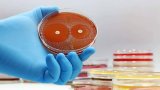 German doctors alarmed at growing failures of antibiotics – Bild