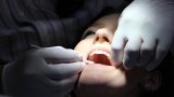 Dentists Demand Crackdown on Quacks