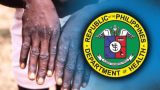 52 mpox cases in PH reported this year – DOH