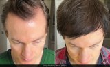 Tech Millionaire Reveals How He Reversed Hair Loss, Shares His Secrets